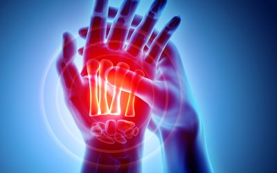 The New Science of Arthritis